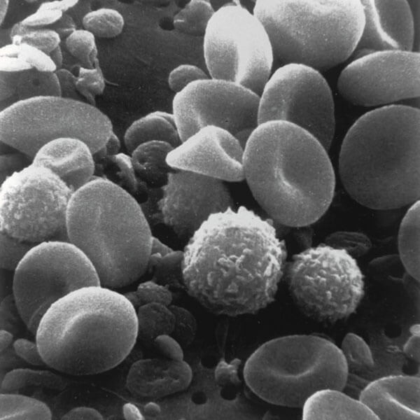 blood-cell image of blood cells